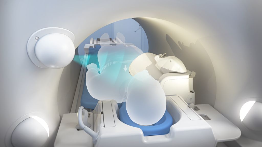 AI detected patient breathing 