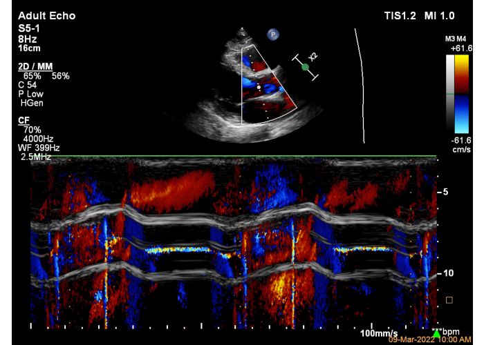 Dispositivi portatili a microonde per diagnostica per immagini - Tecnica  Ospedaliera