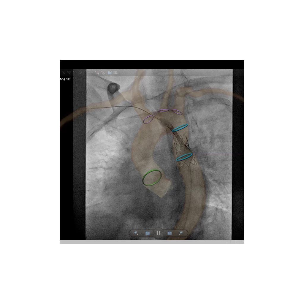 Live X-ray image