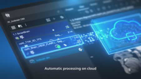 0-click workflow with Smart Reading video