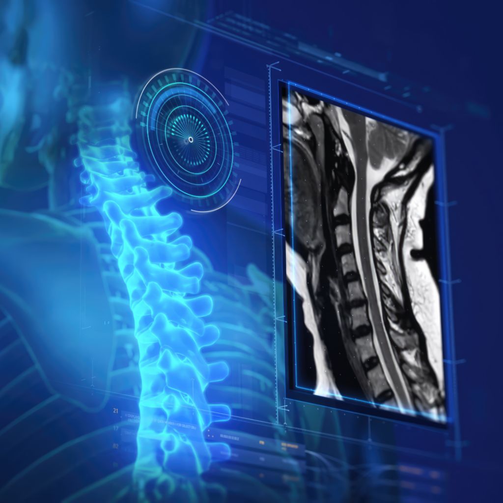 Spine imaging with SmartSpeed