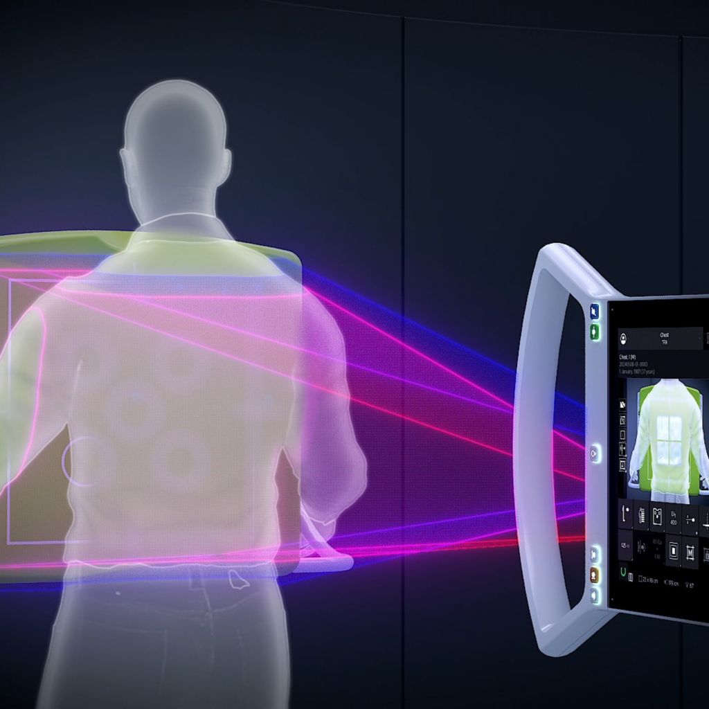 Radiography 7300 C Smart Collimation Thorax 