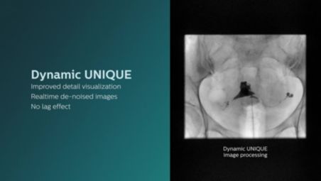 Dynamic UNIQUE image processing - Hidden details revealed video