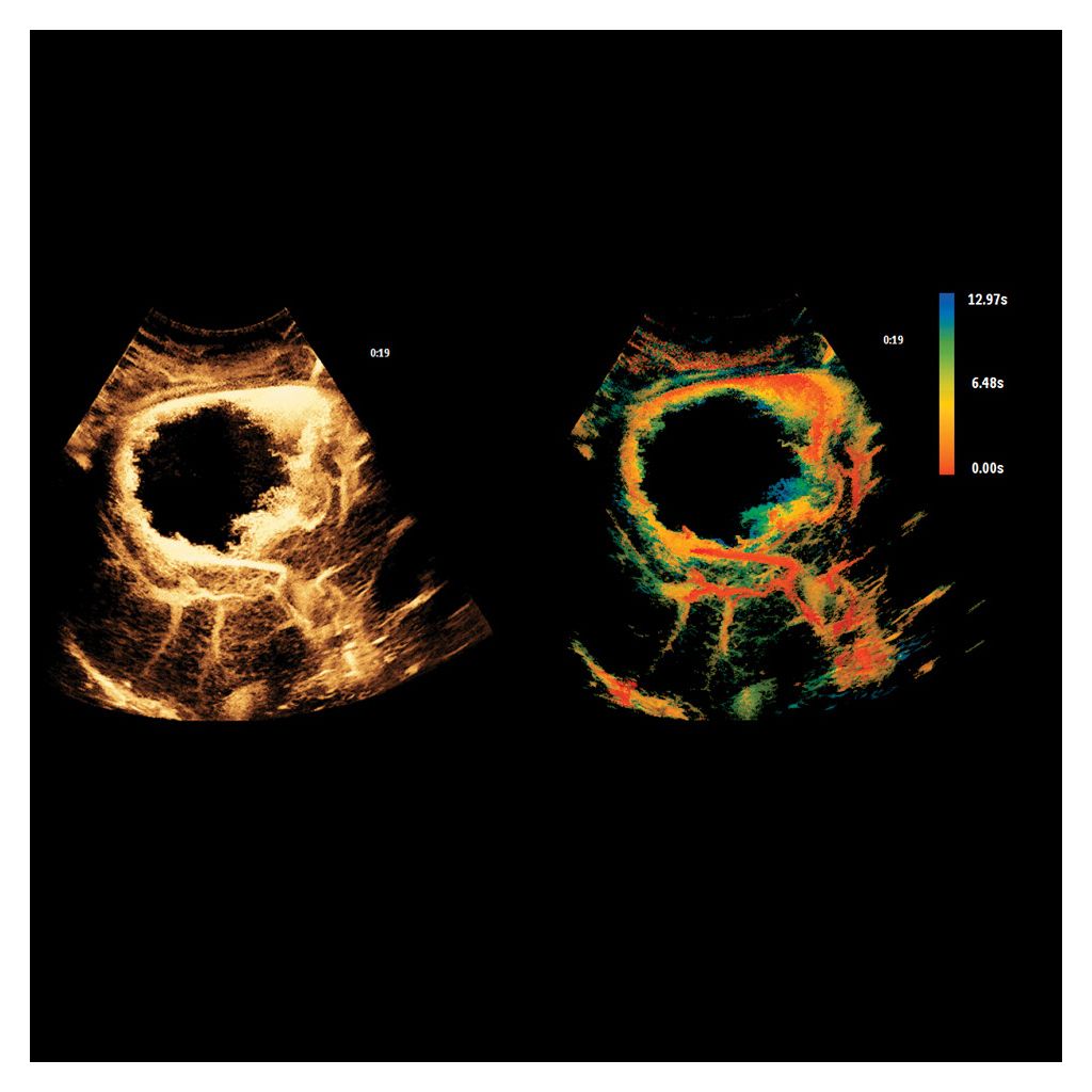 SuperRes MVI & TOA Clinical Image temporal information
