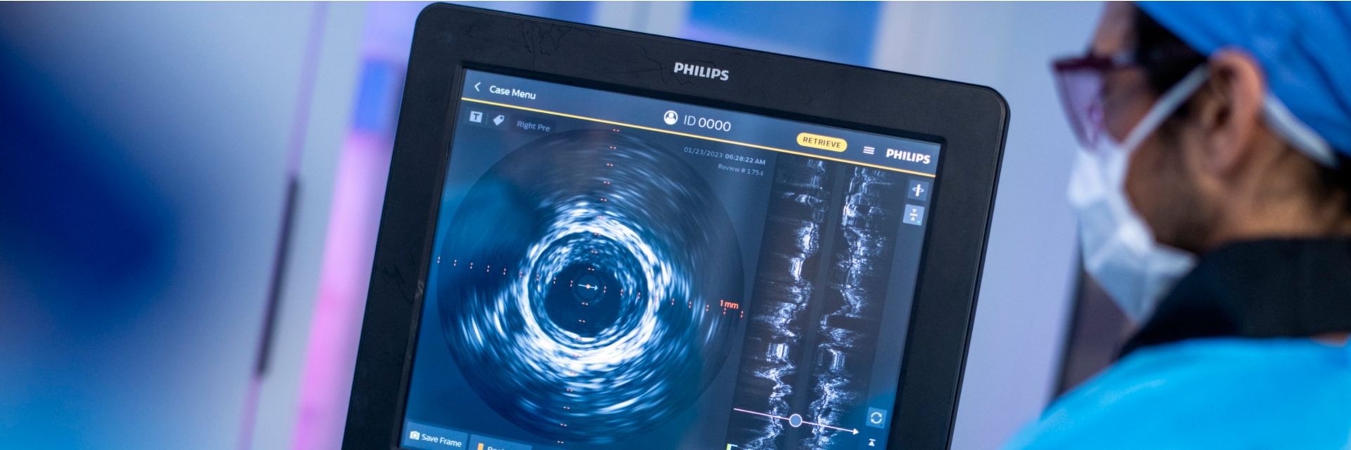 Physician using Philips Peripheral IVUS technology