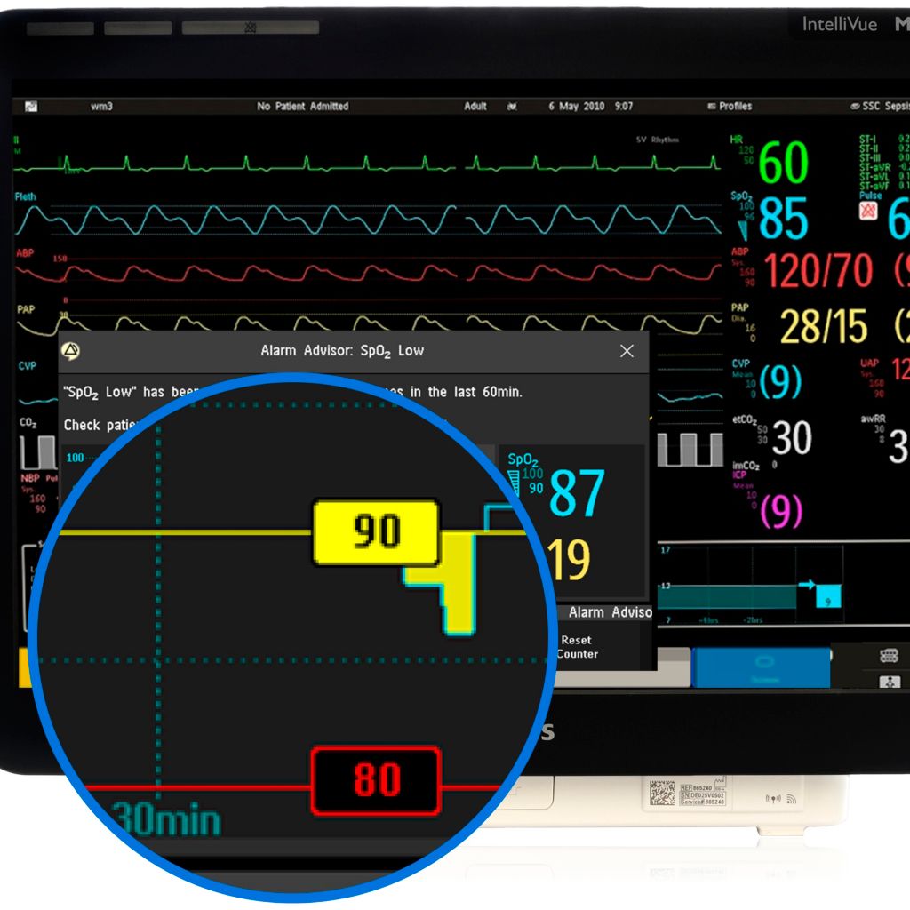 Alarm Advisor