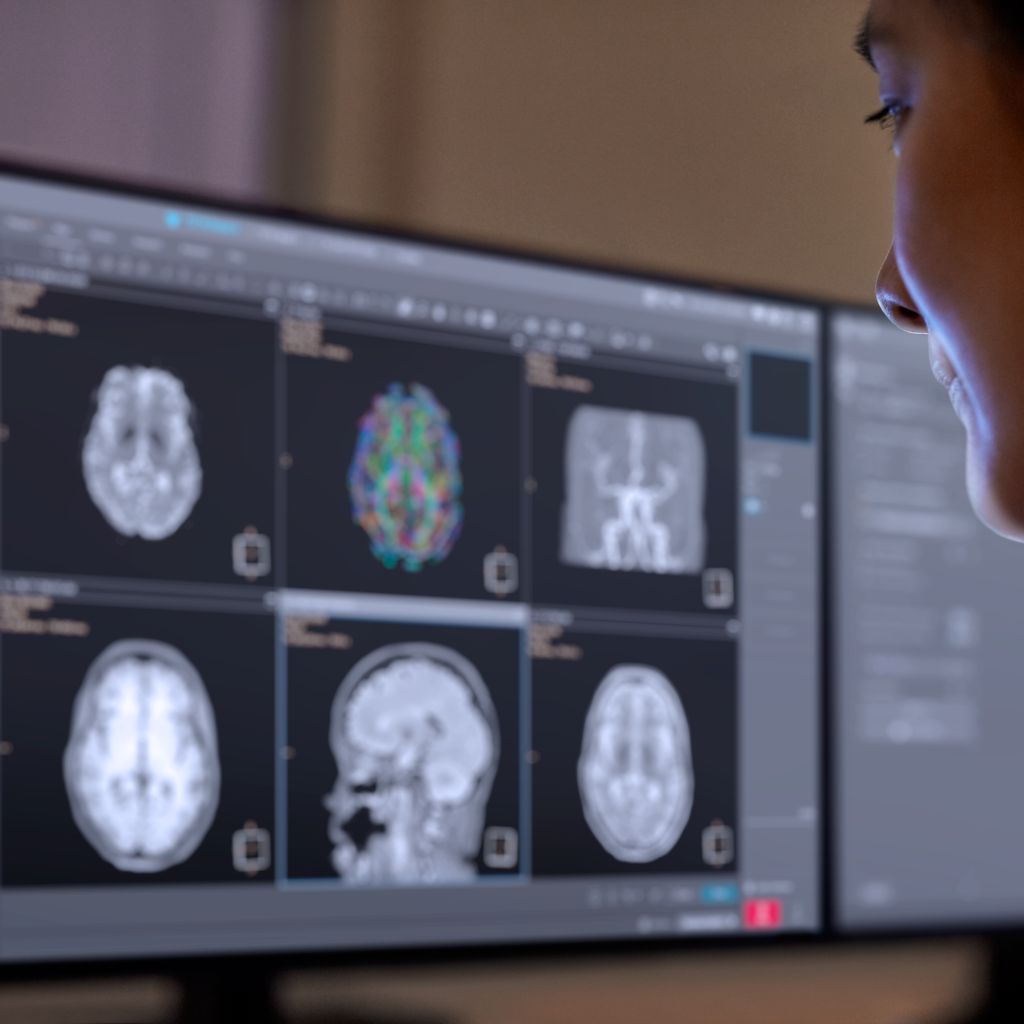 Technologist sitting behind MR console using AI-based protocol assistant