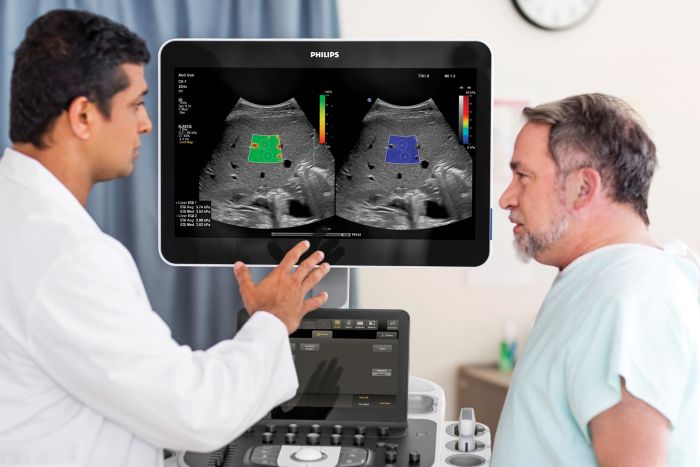 Liver Fat Quantification tool