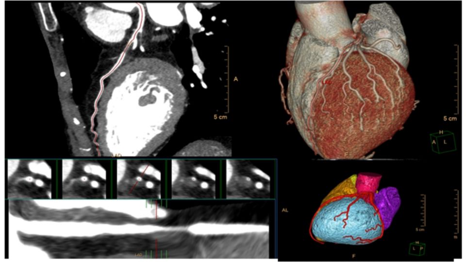 Clinicians review a worklist screen with Philips VuePACS - Media ...