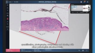 Video Philips IntelliSite Pathology Solution