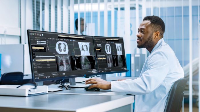 Philips Multimodality RT Simulation Workspace