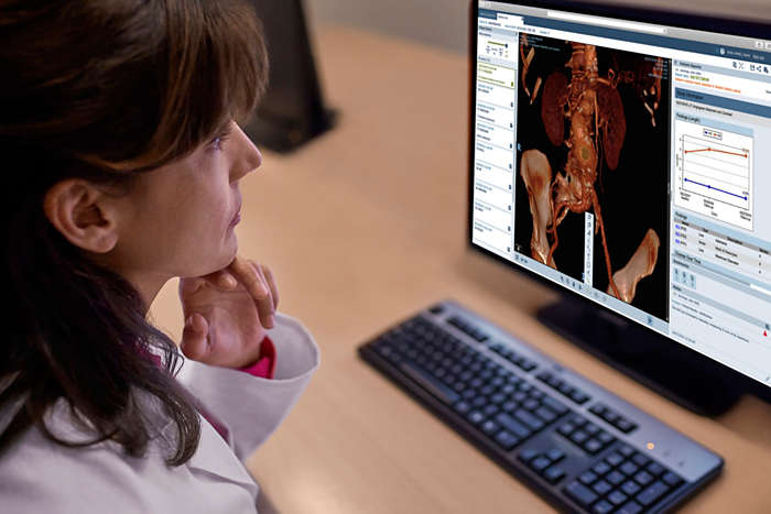 Philips Vue Motion for Radiologists