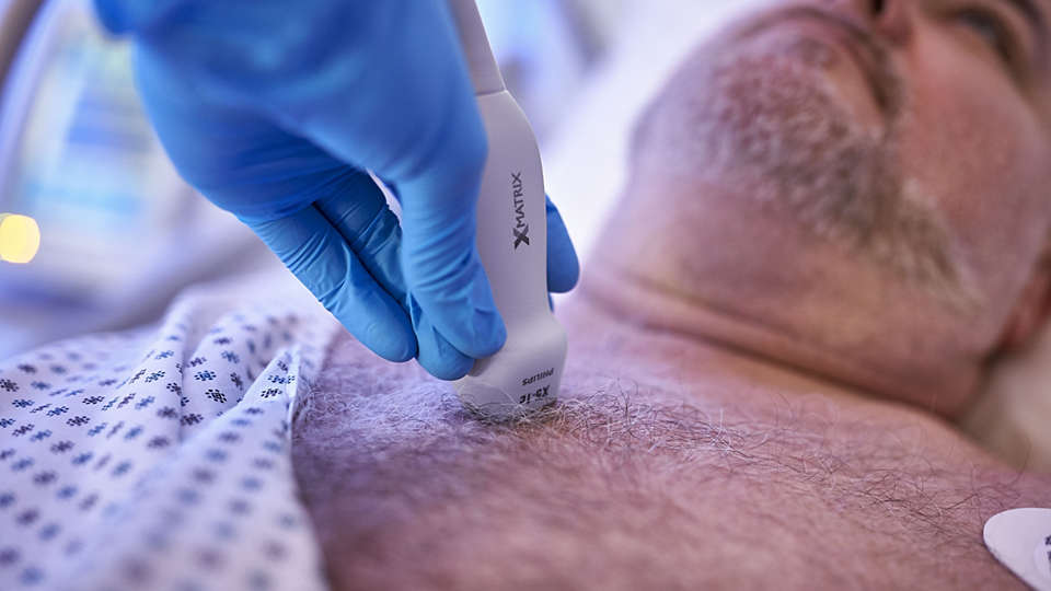 Philips X5 -1c Transthoracic Transducer in use