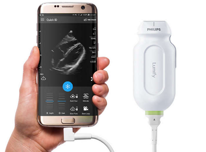 Philips Lumify product card image