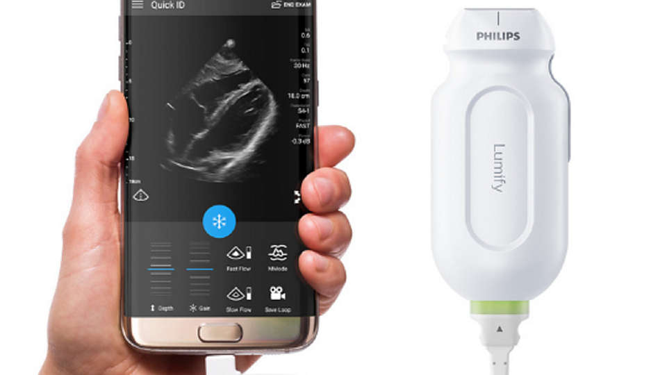 Product shot of Philips Lumify handheld ultrasound