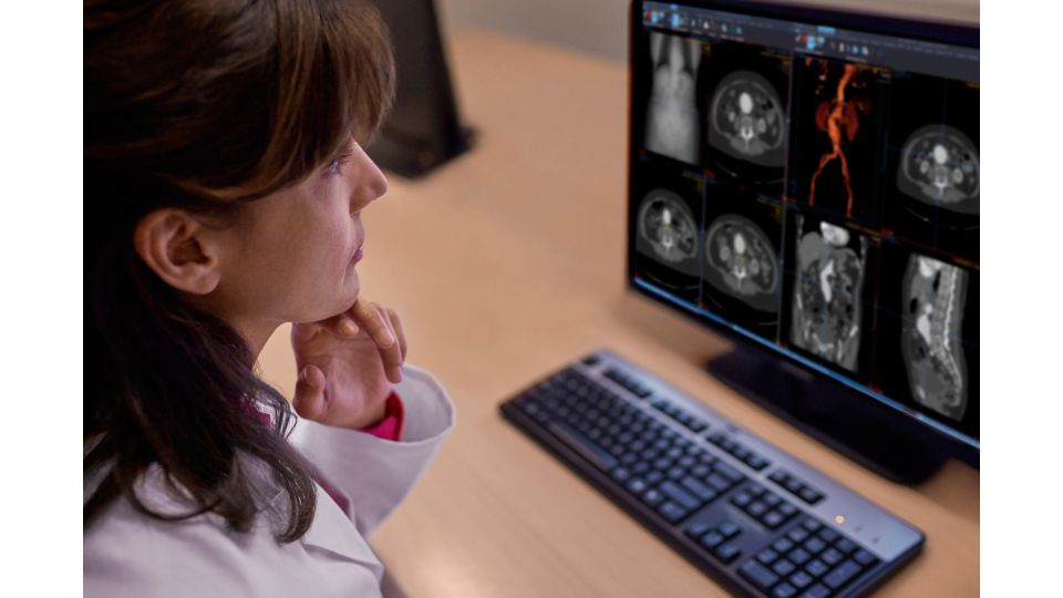 Radiologist using cloud-based PACS - Media library | Philips