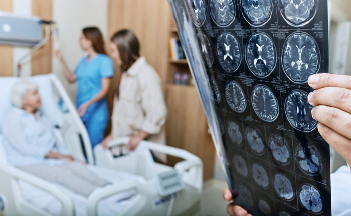Stroke patient recovering