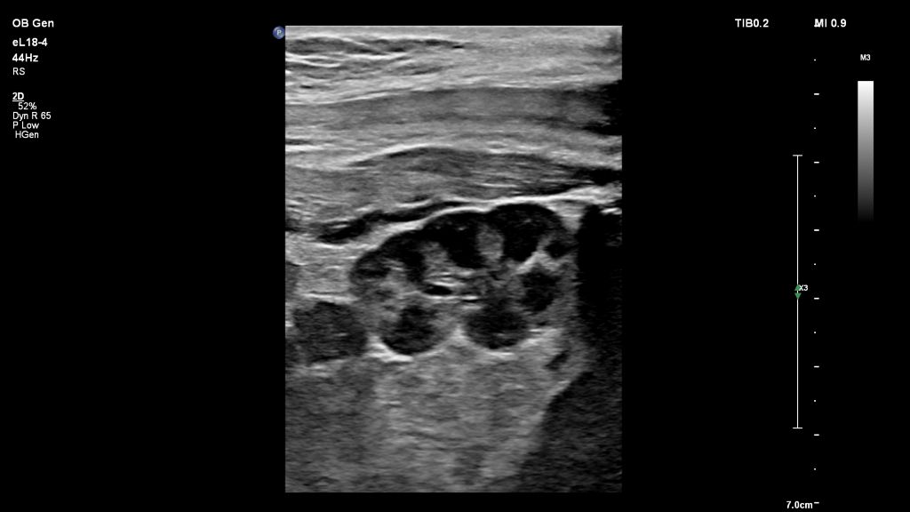 Kidney eL18-4