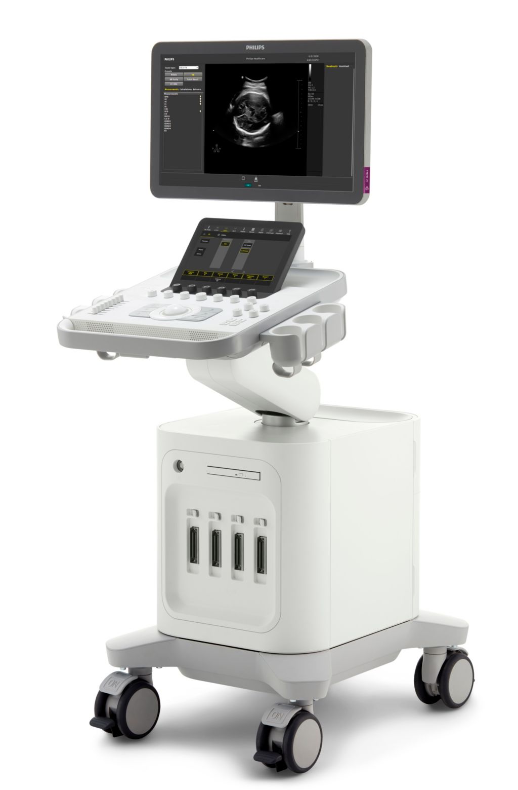 Philips 3300 side photo