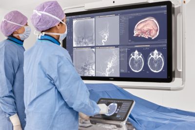 Clinicians using Philips Azurion 7M20 system reviewing SmartCT cerebral imaging during procedure

