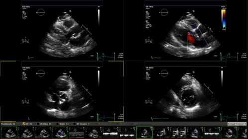 Ultrasound Workspace Image Review