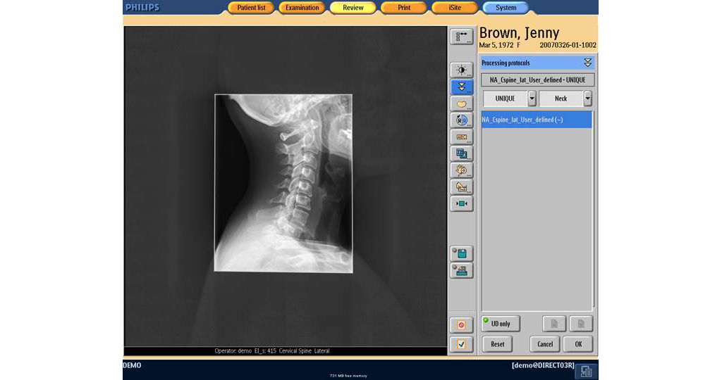 Simplifies exposure control