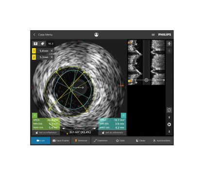 IntraSight Платформа для интервенционных вмешательств | Philips