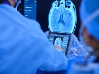 Sistema de diagnóstico por imagen muestra una exploración cerebral.