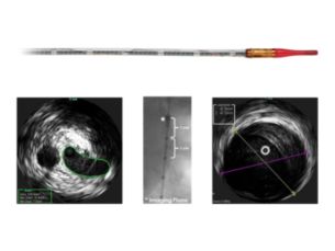 Visions PV .035 Digital IVUS catheter