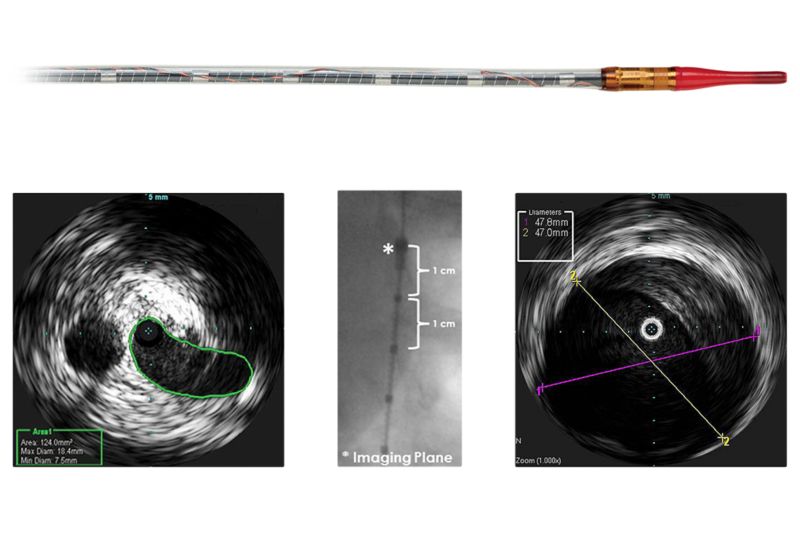 Visions PV .035 OTW — Digital IVUS Catheter
