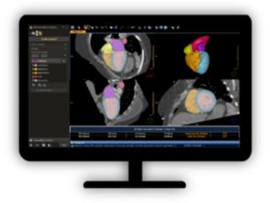 CT Pulmonary Artery Analysis​ Assess suspected findings of pulmonary embolism