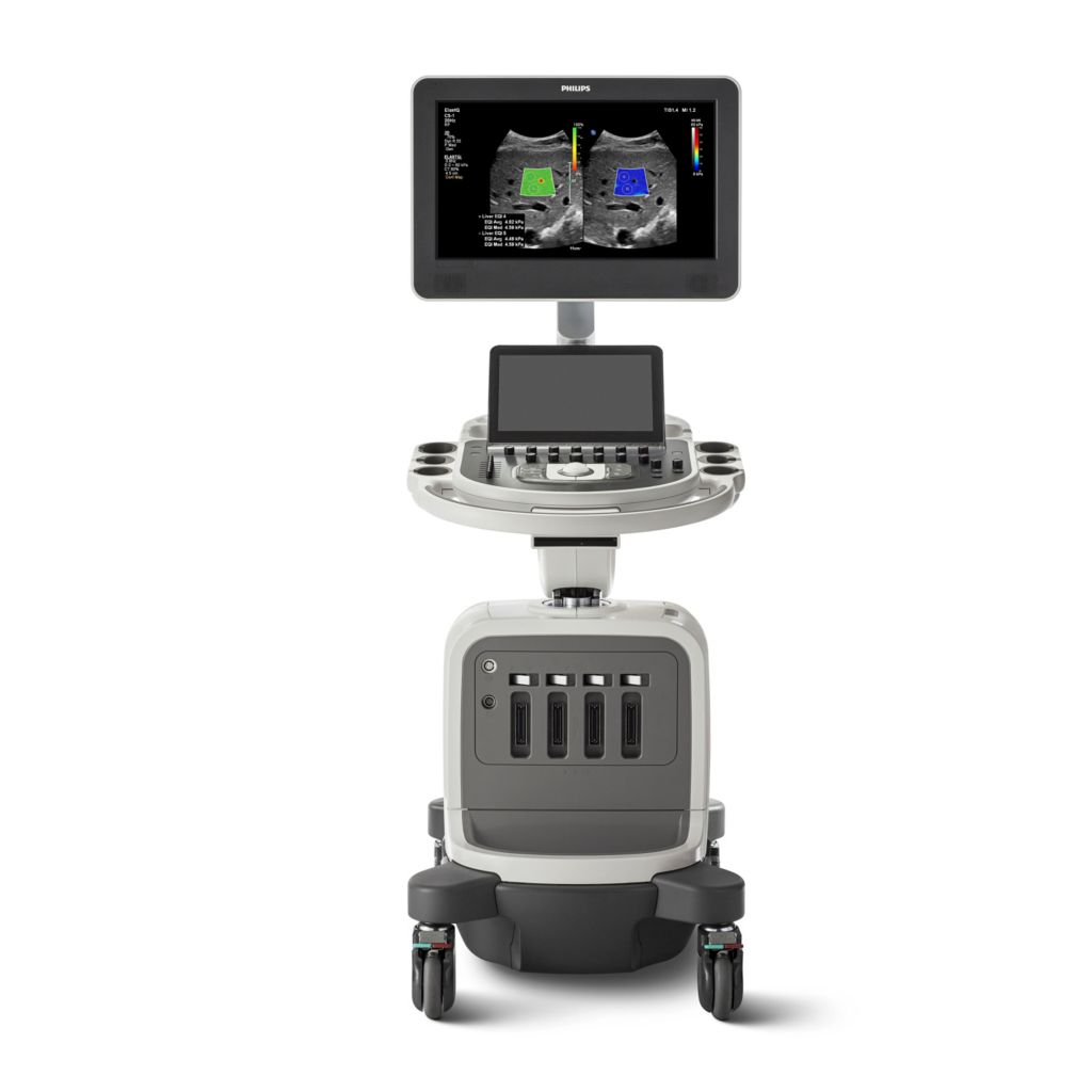 Affiniti Ultrasound system