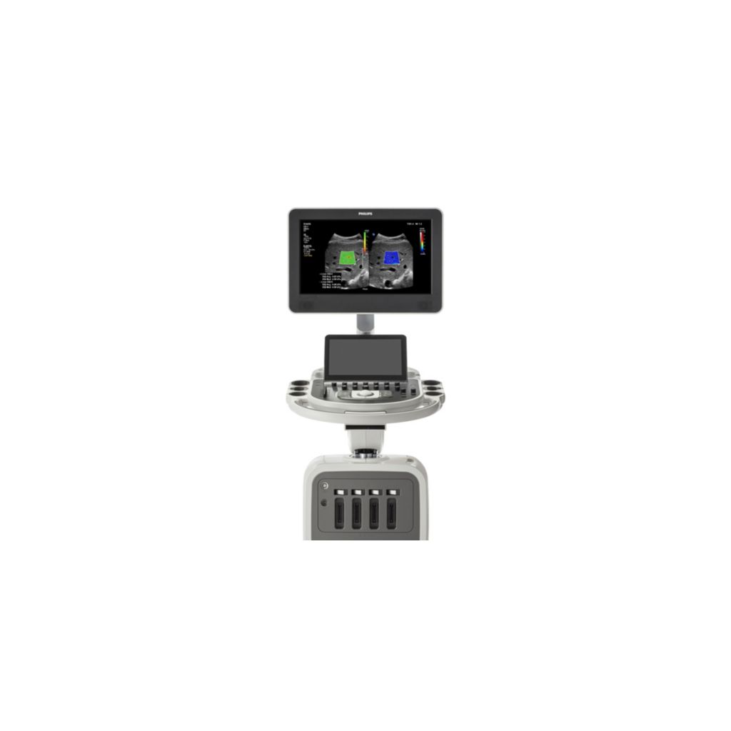 Affiniti ultrasound