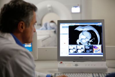 Philips Spectral CT 7500システムの側面画像