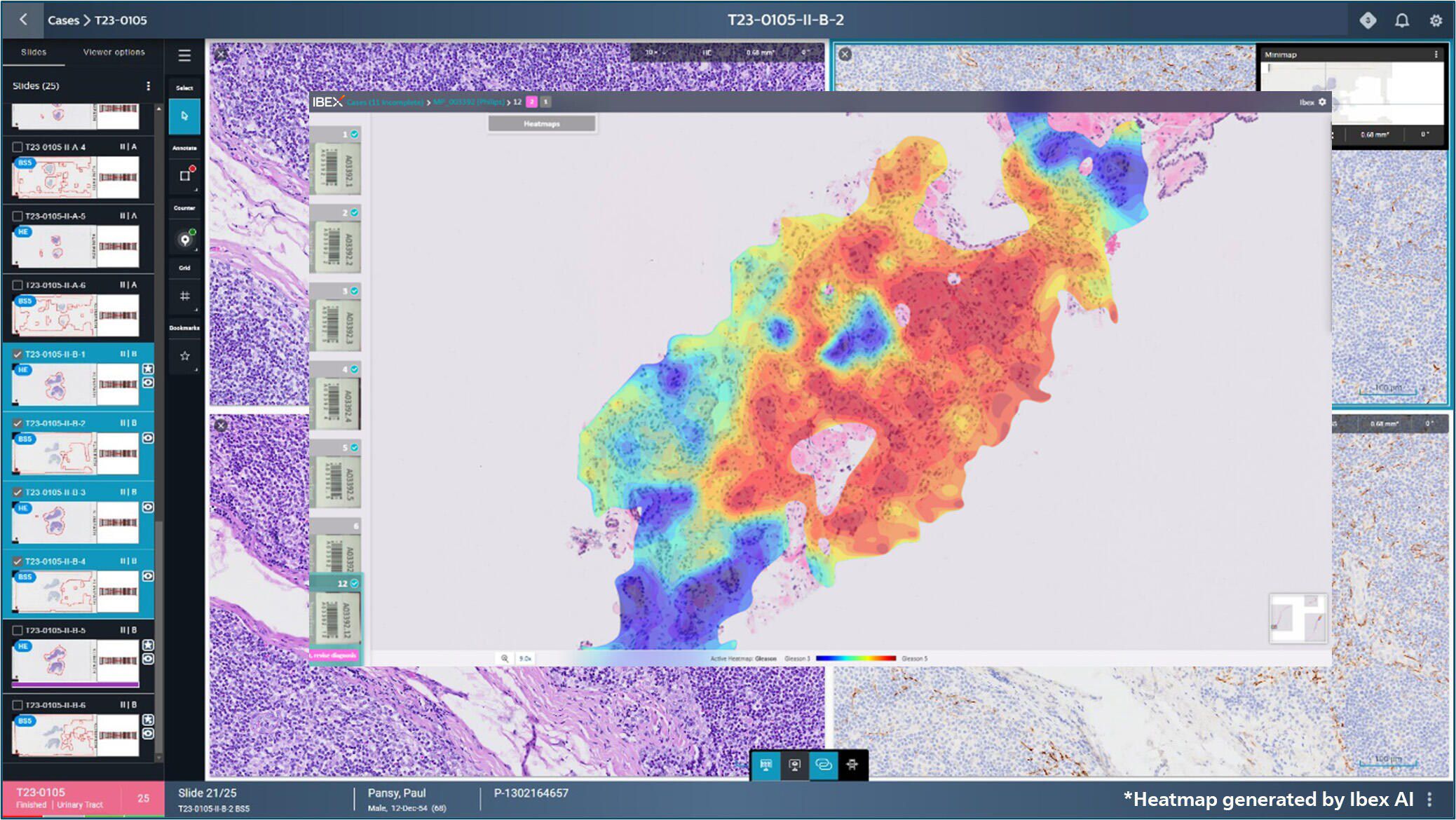 A computer-generated heatmap displayed on a digital imaging platform with tissue samples around it