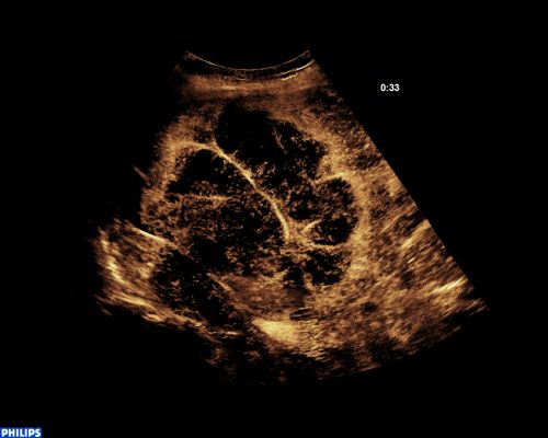SuperRes MVI & TOA Clinical Image temporal information