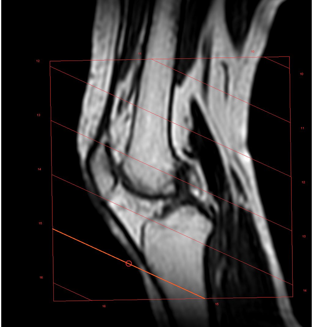 SmartExam Knee