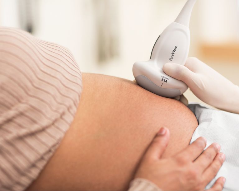 High-frequency transducers