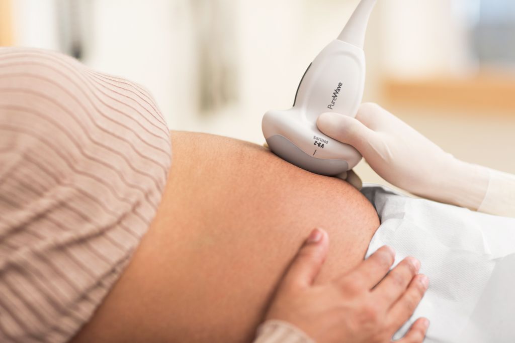 EPIQ Elite OB scan with V9-2