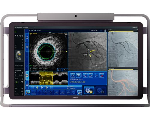 Philips full picture