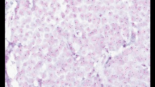 Clinical image digital pathology