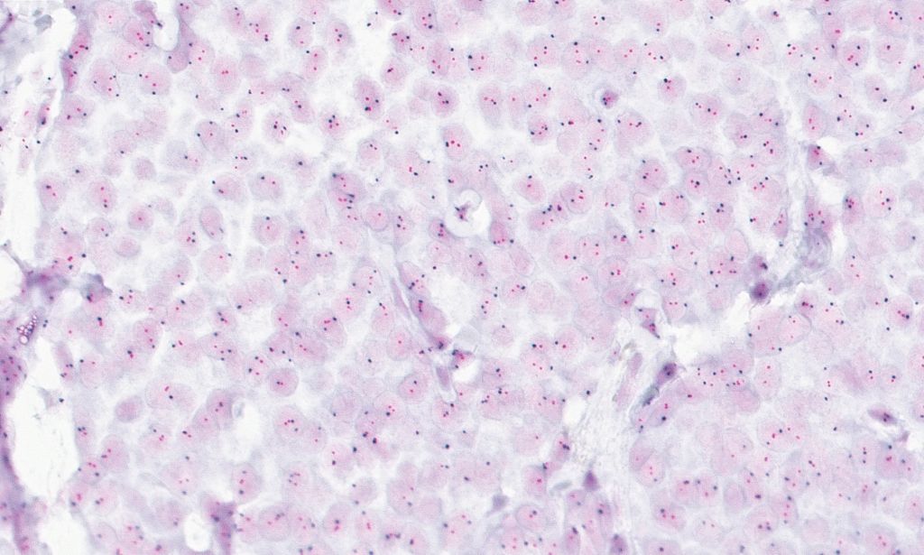 Clinical image digital pathology