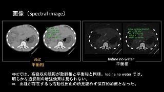 case 81
小児多時相撮影の工夫 ～被ばく線量低減と造影剤量低減の両立～