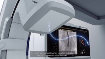 Transesophageal Echocardiogram - Garani Cardiac Centre