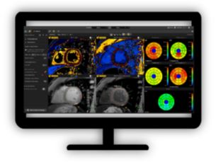 MR Cardiac Quantitative Mapping Assess myocardial tissue characteristics