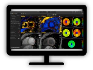 MR Cardiac Quantitative Mapping Assess myocardial tissue characteristics