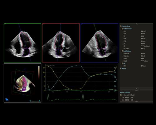 Heart function, echo AI application interface