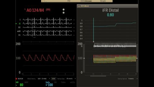 User interface - PB exam room