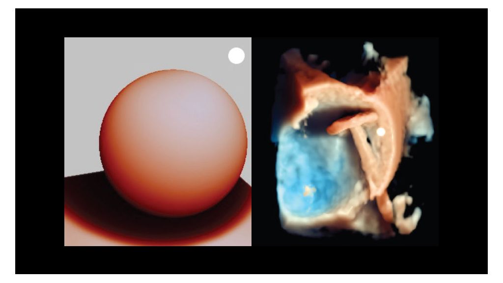 Clinical image – TrueVue models absorption of light in tissue is wavelength dependency