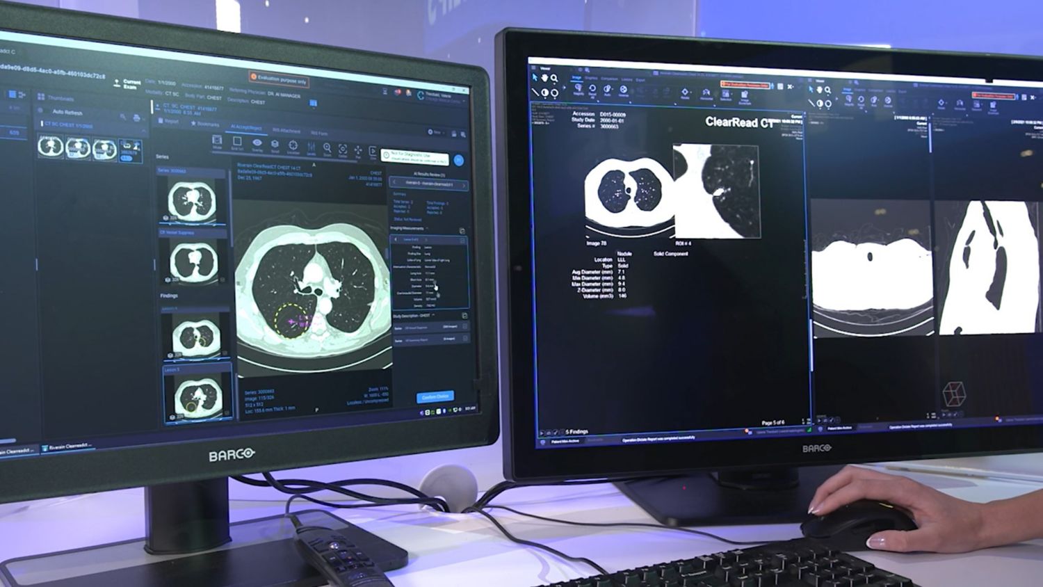 two monitor screens with scan results